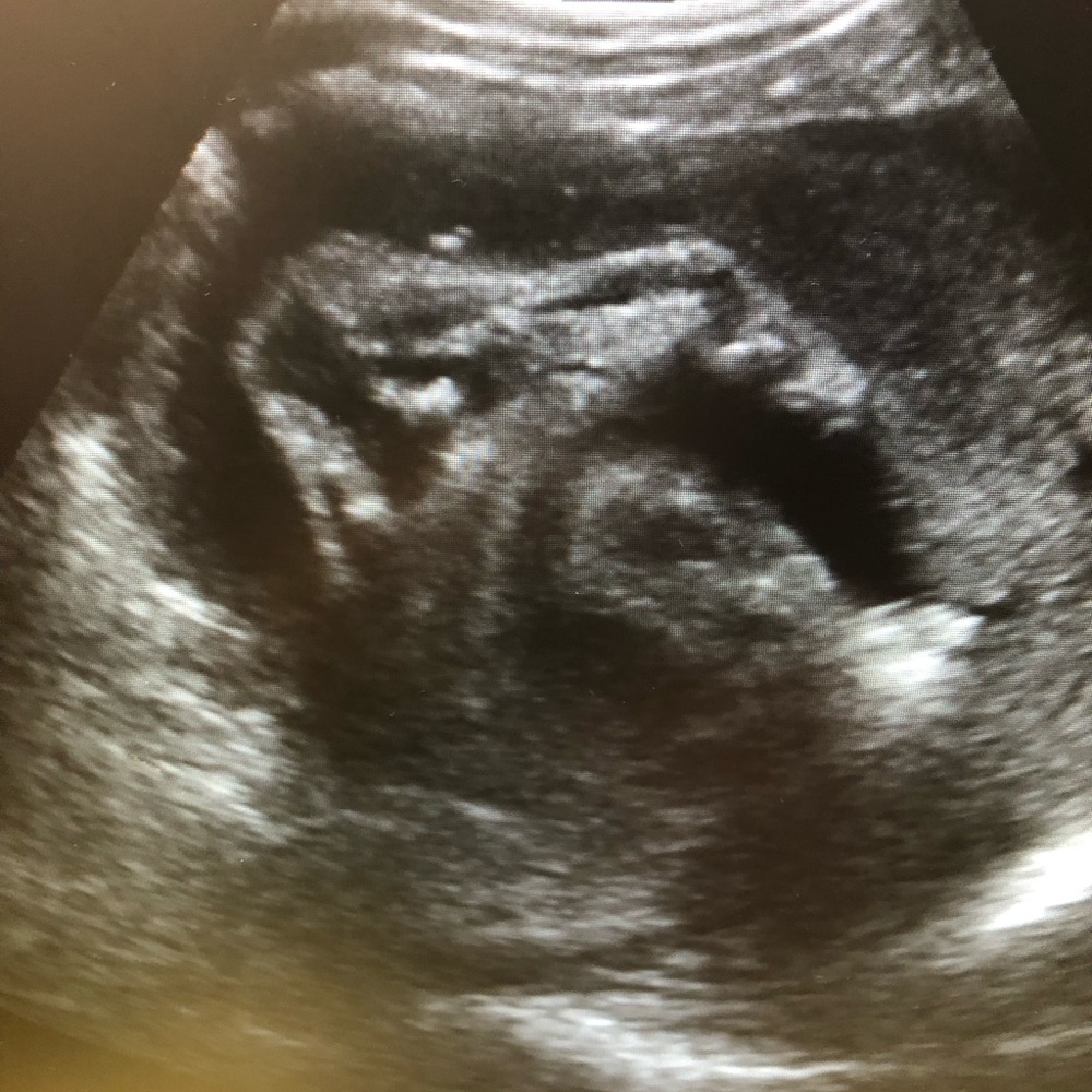 Meet your Posher, Nicholle